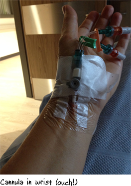 Cannula in wrist